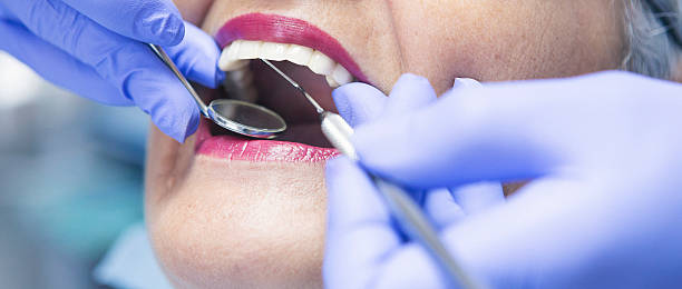Best Emergency Denture Repair in Bellaire, TX